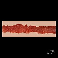 Zelex - Textur des Analkanals (Stand: 06/2024)